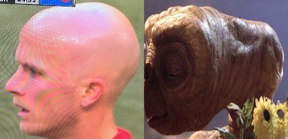Michael Bradley's oblong head, as contrasted with that of E.T's.